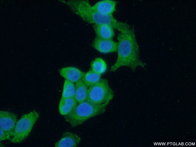 LIMK1 Antibody in Immunocytochemistry (ICC/IF)