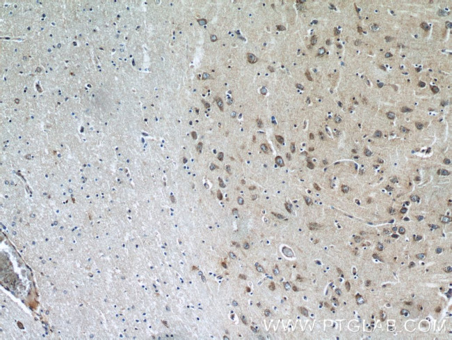 LIMK1 Antibody in Immunohistochemistry (Paraffin) (IHC (P))