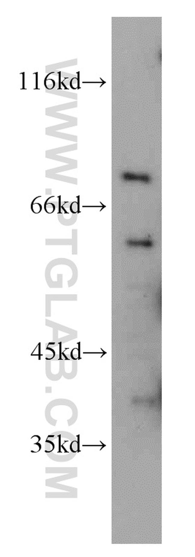 LIMK1 Antibody in Western Blot (WB)