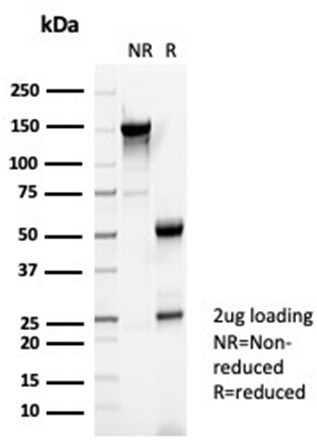 Reelin Antibody in SDS-PAGE (SDS-PAGE)