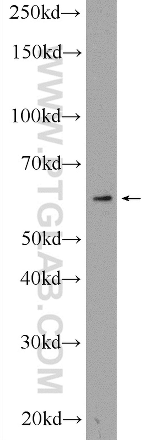 CYP4F3 Antibody in Western Blot (WB)