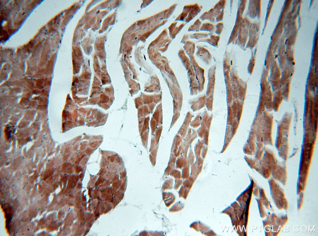 NEB Antibody in Immunohistochemistry (Paraffin) (IHC (P))