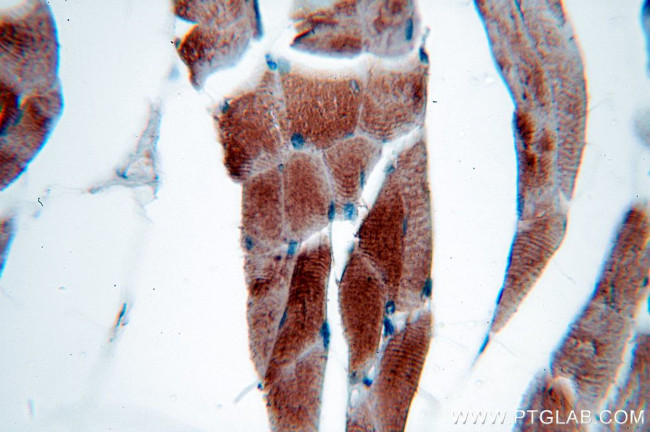 NEB Antibody in Immunohistochemistry (Paraffin) (IHC (P))