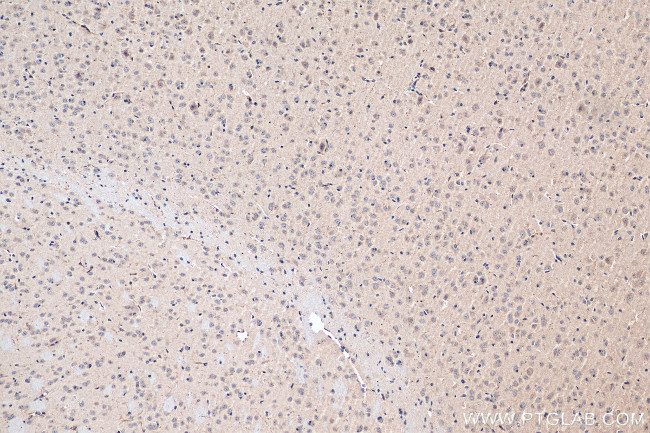 neurturin Antibody in Immunohistochemistry (Paraffin) (IHC (P))