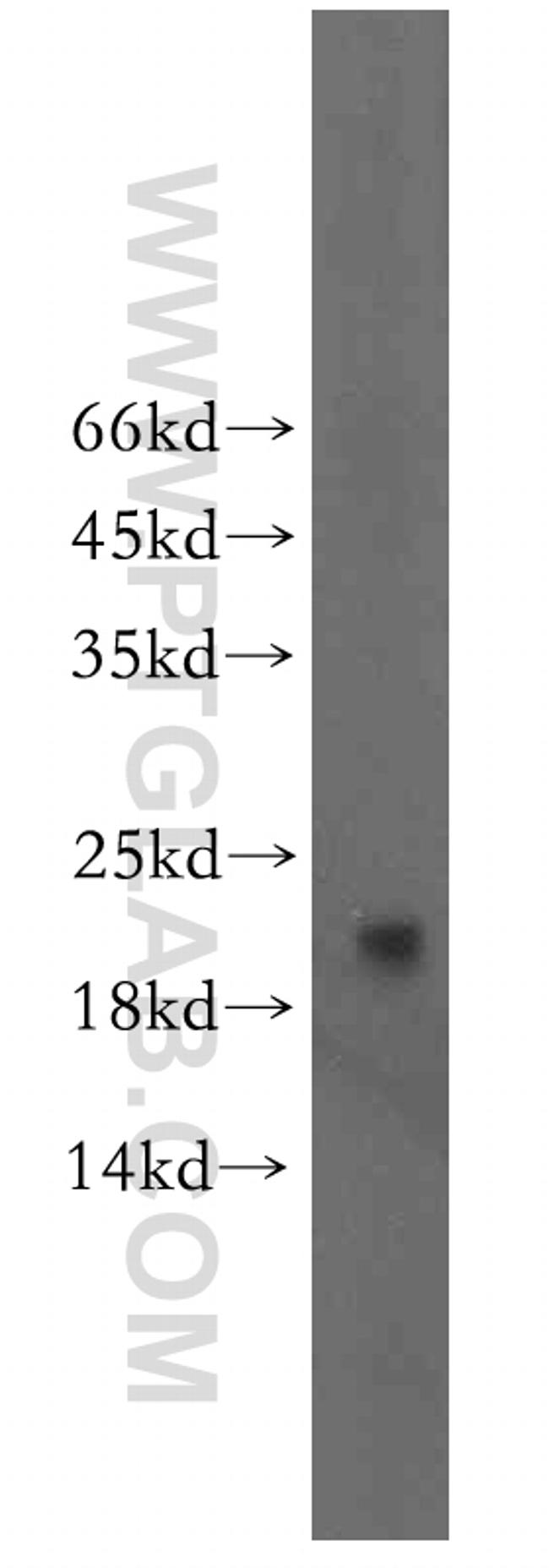 neurturin Antibody in Western Blot (WB)