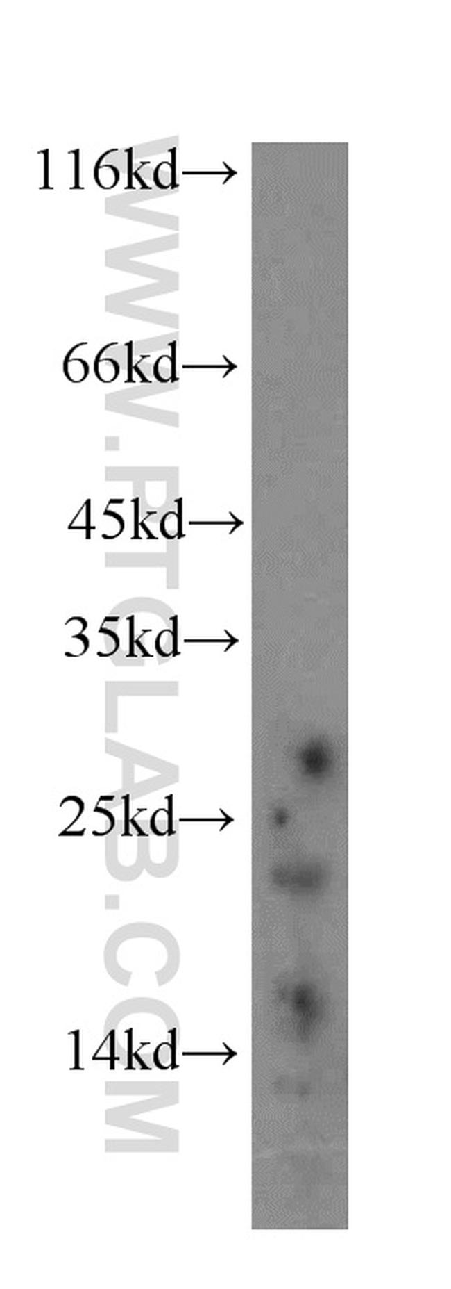 neurturin Antibody in Western Blot (WB)