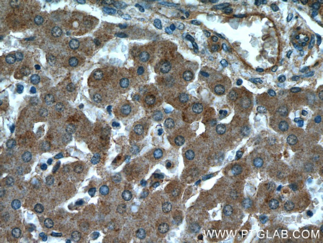 PYGM Antibody in Immunohistochemistry (Paraffin) (IHC (P))