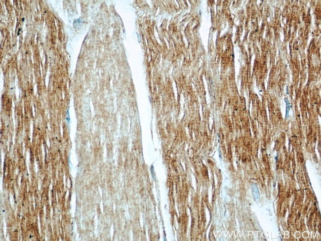 PYGM Antibody in Immunohistochemistry (Paraffin) (IHC (P))