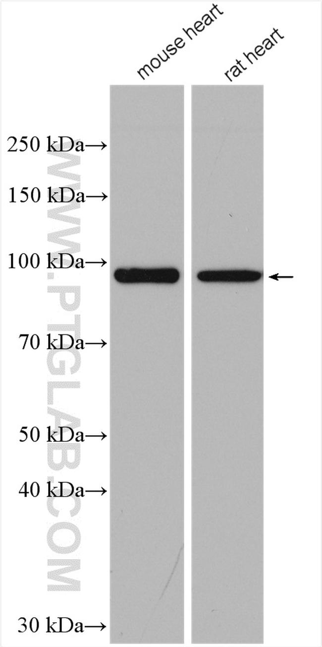 PYGM Antibody in Western Blot (WB)