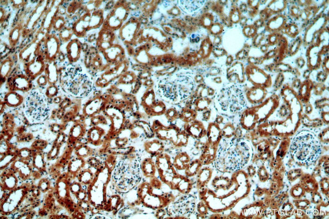 SPTBN1 Antibody in Immunohistochemistry (Paraffin) (IHC (P))