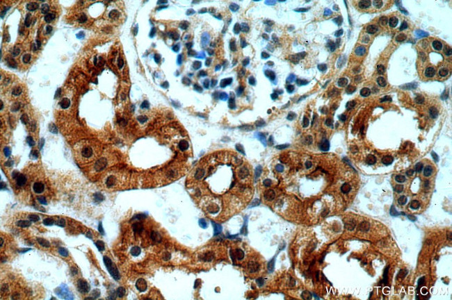 SPTBN1 Antibody in Immunohistochemistry (Paraffin) (IHC (P))