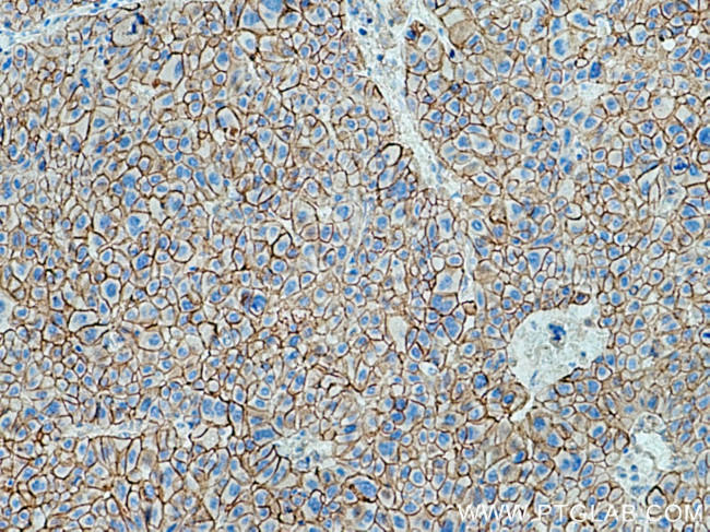 SPTBN1 Antibody in Immunohistochemistry (Paraffin) (IHC (P))