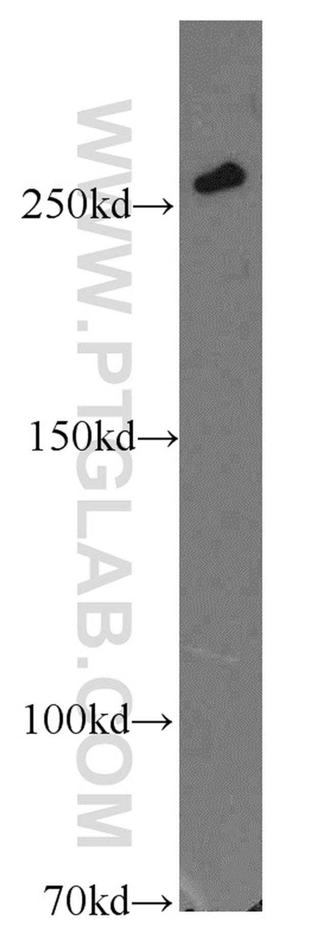 SPTBN1 Antibody in Western Blot (WB)