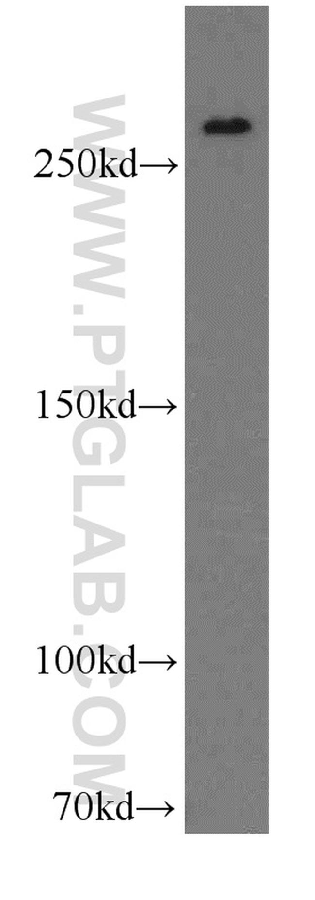 SPTBN1 Antibody in Western Blot (WB)