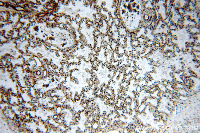 SPTBN1 Antibody in Immunohistochemistry (Paraffin) (IHC (P))