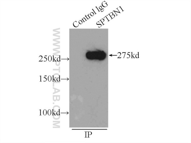 SPTBN1 Antibody in Immunoprecipitation (IP)