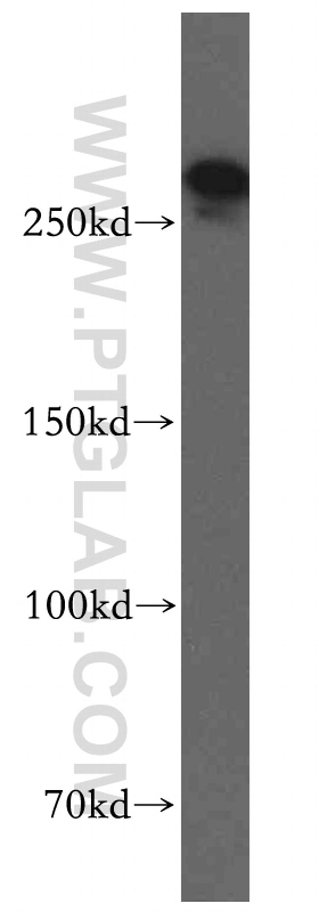 SPTBN1 Antibody in Western Blot (WB)