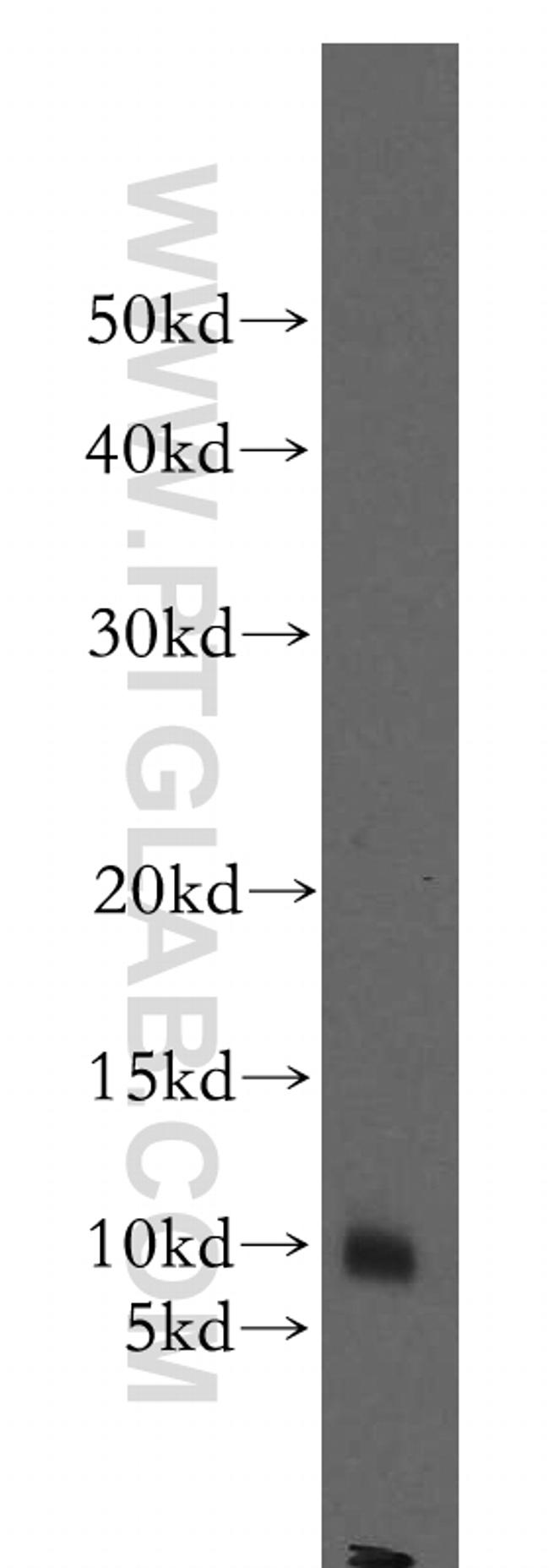 STATH Antibody in Western Blot (WB)