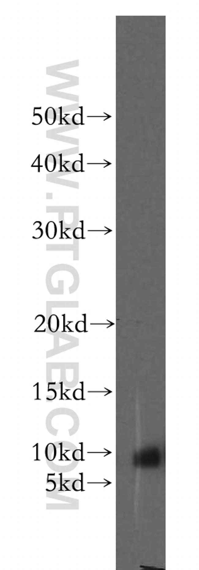 STATH Antibody in Western Blot (WB)