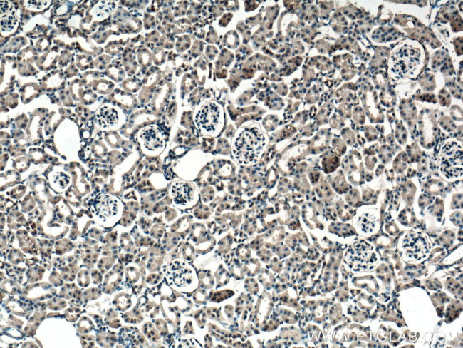 Thrombospondin 3 Antibody in Immunohistochemistry (Paraffin) (IHC (P))