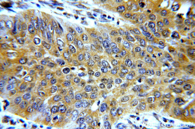 TMF1 Antibody in Immunohistochemistry (Paraffin) (IHC (P))