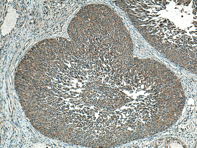 TMF1 Antibody in Immunohistochemistry (Paraffin) (IHC (P))