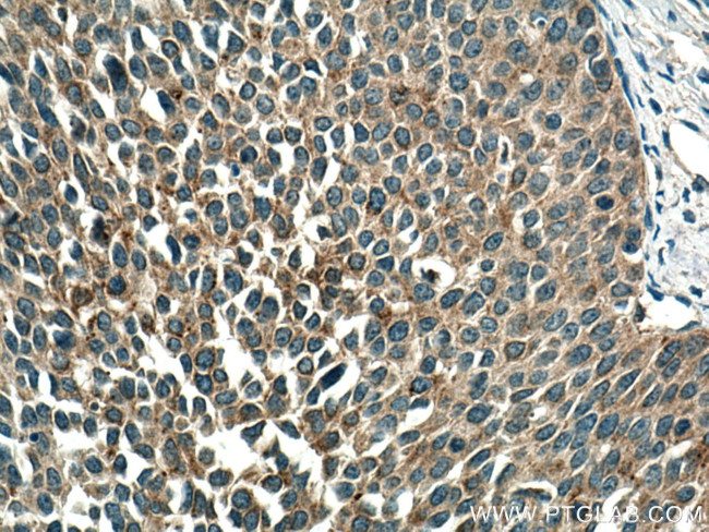 TMF1 Antibody in Immunohistochemistry (Paraffin) (IHC (P))