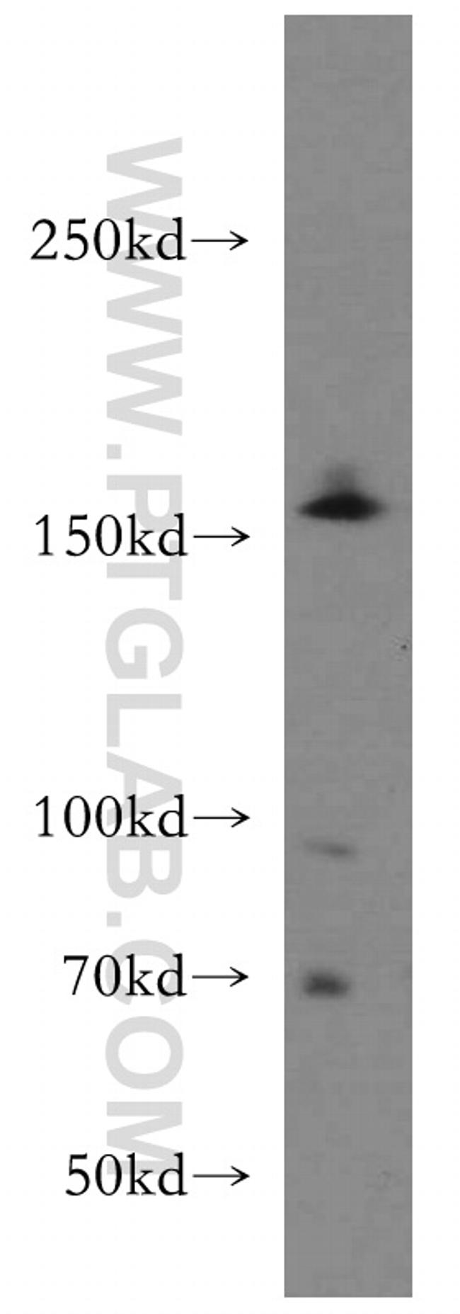 TMF1 Antibody in Western Blot (WB)