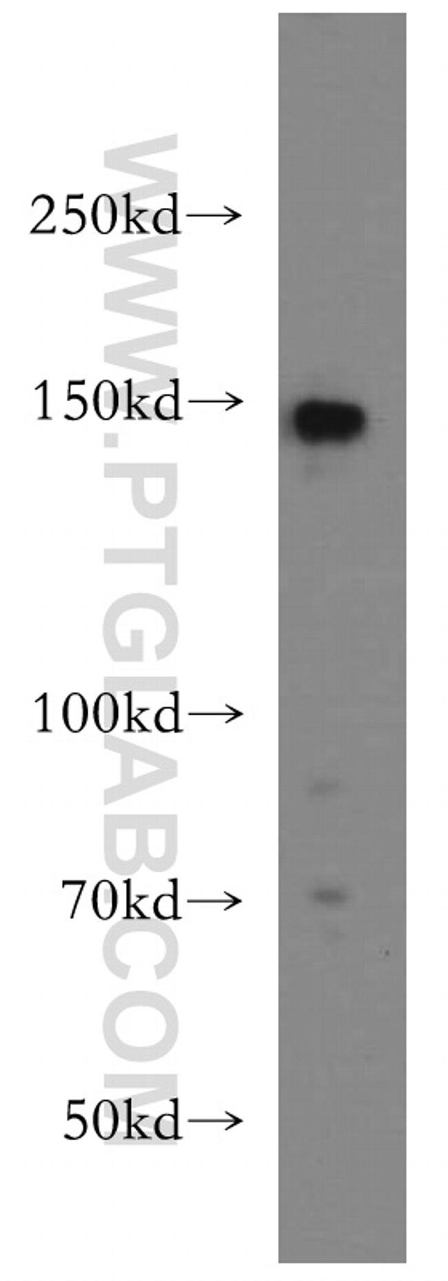 TMF1 Antibody in Western Blot (WB)