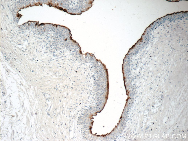 UPK2 Antibody in Immunohistochemistry (Paraffin) (IHC (P))