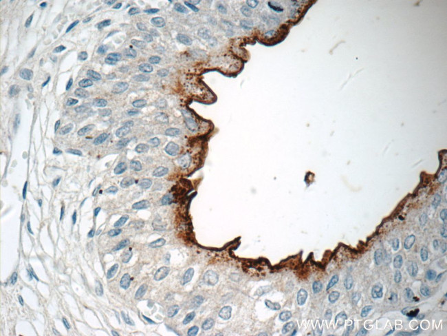 UPK2 Antibody in Immunohistochemistry (Paraffin) (IHC (P))