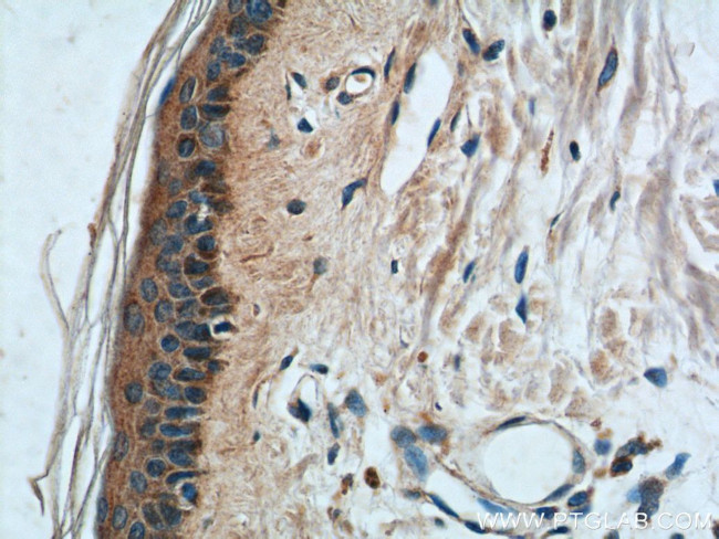 ST8SIA2 Antibody in Immunohistochemistry (Paraffin) (IHC (P))