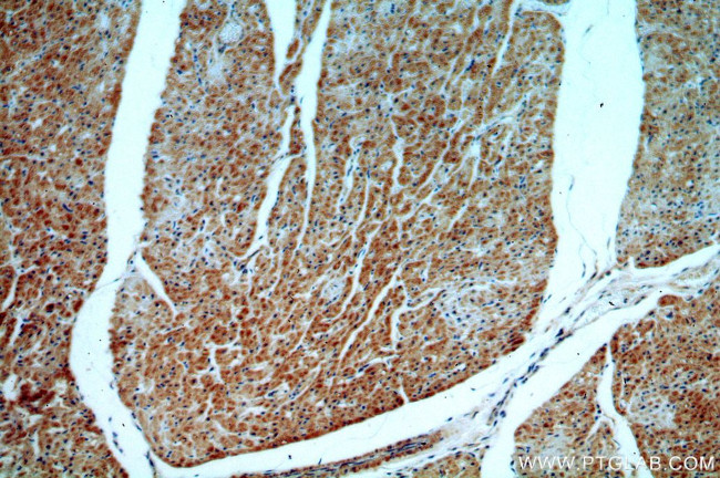 ST8SIA2 Antibody in Immunohistochemistry (Paraffin) (IHC (P))