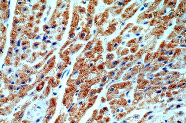 ST8SIA2 Antibody in Immunohistochemistry (Paraffin) (IHC (P))