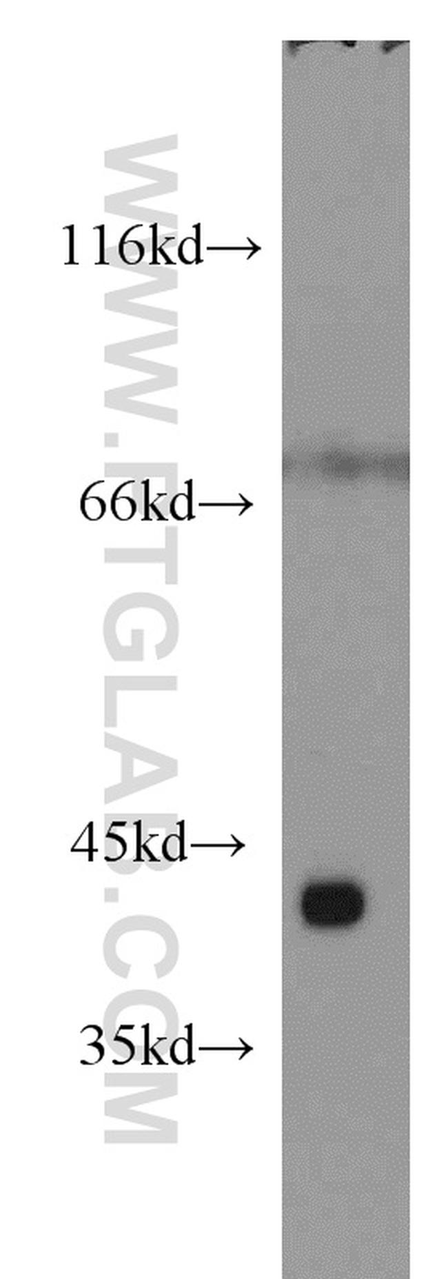 ST8SIA2 Antibody in Western Blot (WB)