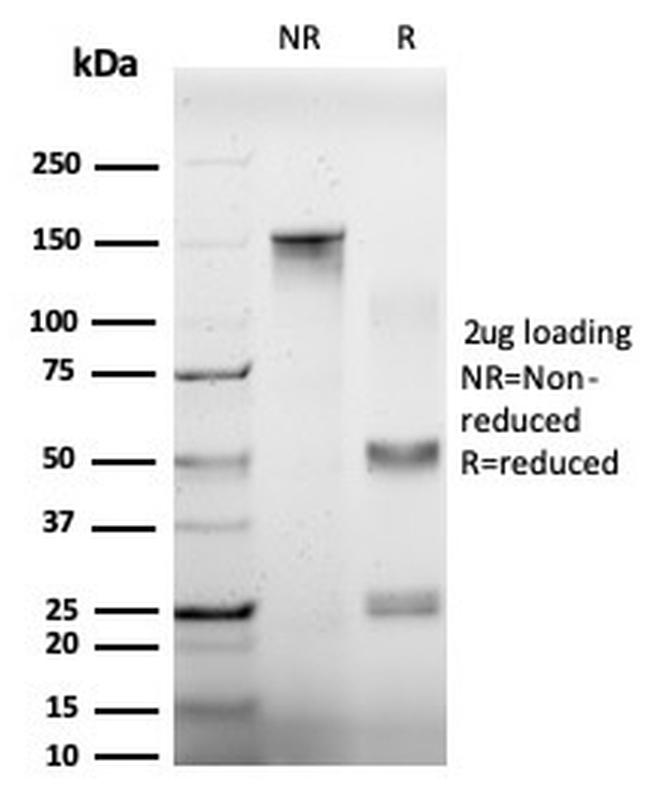 EIF4A2 (Eukaryotic Initiation Factor 4A-II) Antibody in SDS-PAGE (SDS-PAGE)