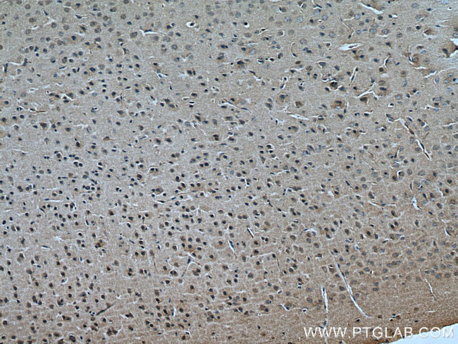 KALRN Antibody in Immunohistochemistry (Paraffin) (IHC (P))