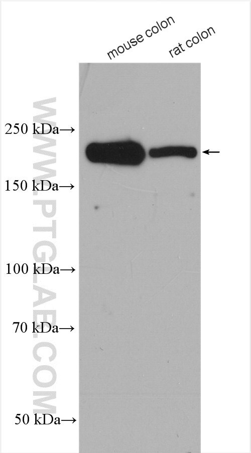 KALRN Antibody in Western Blot (WB)