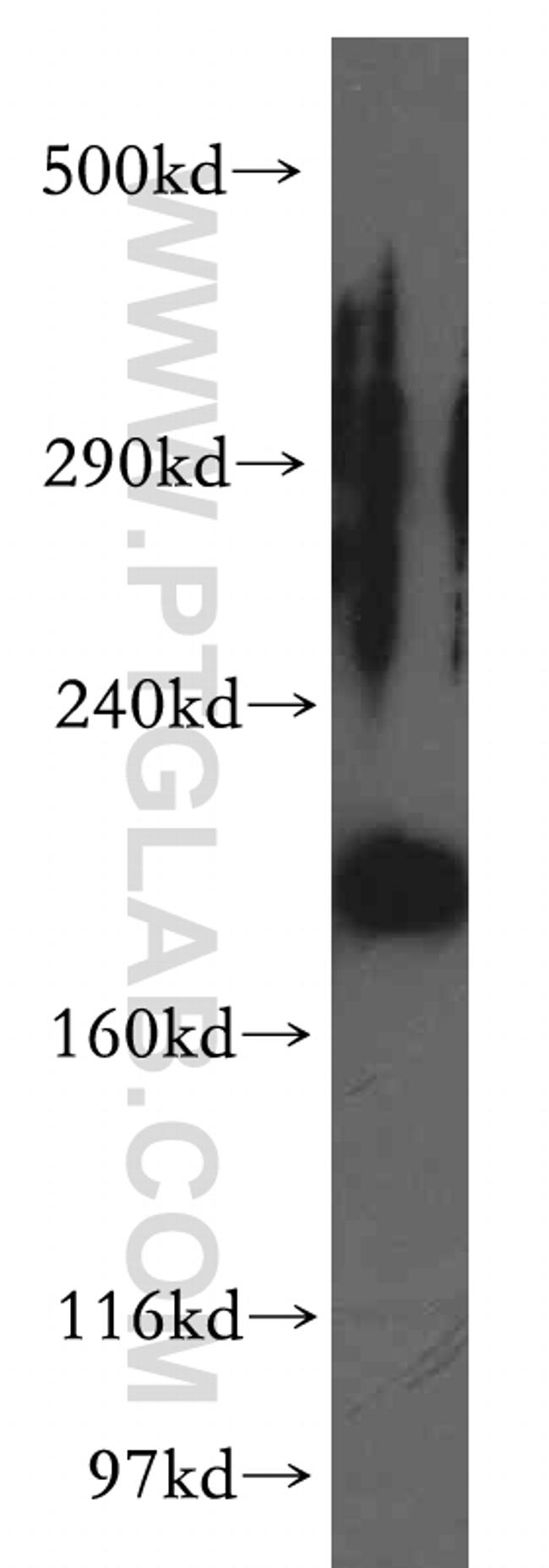 KALRN Antibody in Western Blot (WB)