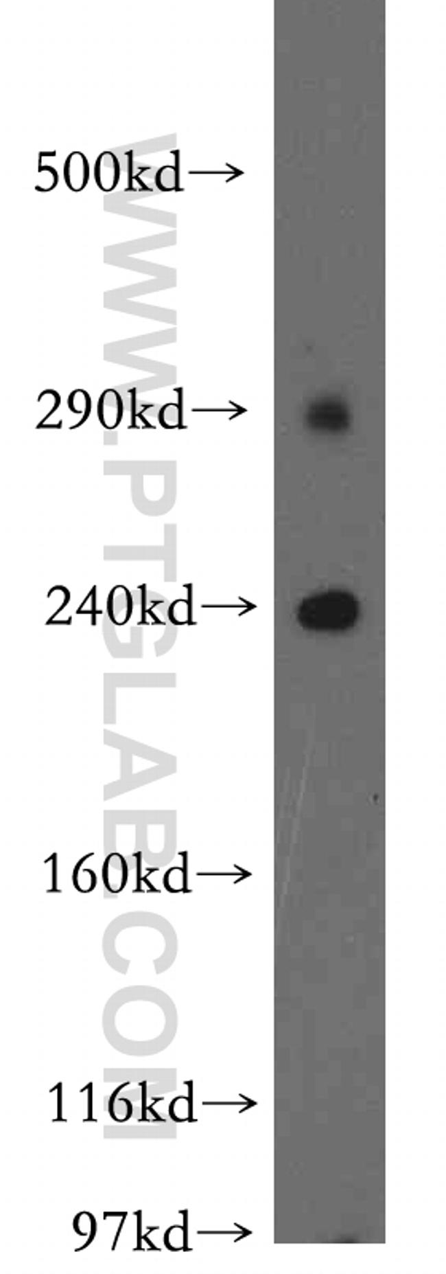 KALRN Antibody in Western Blot (WB)