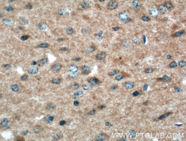 KALRN Antibody in Immunohistochemistry (Paraffin) (IHC (P))