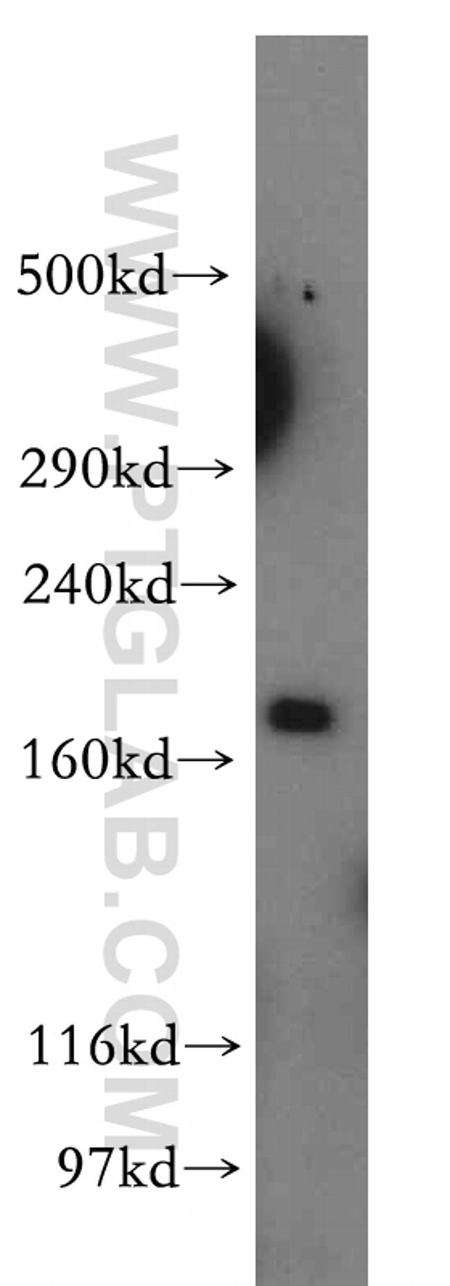 KALRN Antibody in Western Blot (WB)