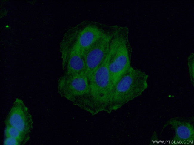 RAB11B Antibody in Immunocytochemistry (ICC/IF)