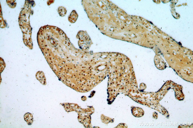 RAB11B Antibody in Immunohistochemistry (Paraffin) (IHC (P))