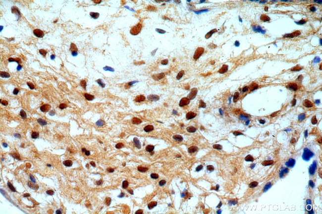 RAB11B Antibody in Immunohistochemistry (Paraffin) (IHC (P))