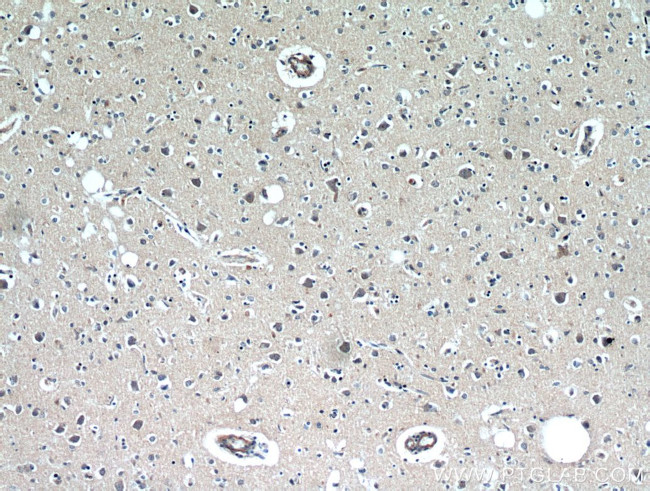 RAB11B Antibody in Immunohistochemistry (Paraffin) (IHC (P))