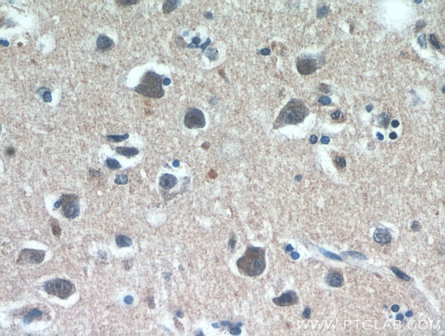 RAB11B Antibody in Immunohistochemistry (Paraffin) (IHC (P))