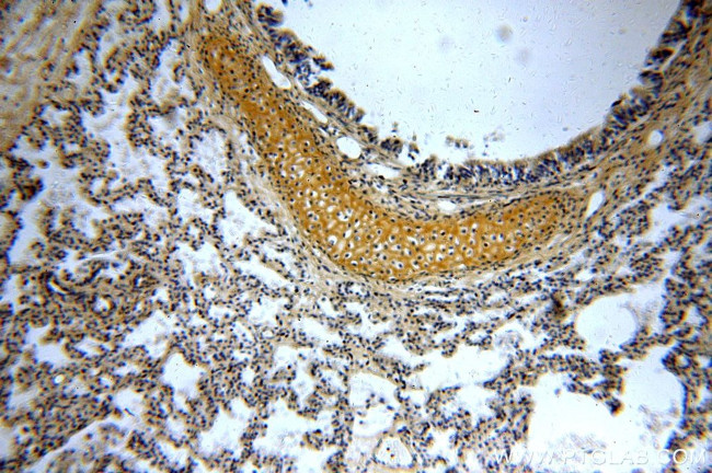 RAB11B Antibody in Immunohistochemistry (Paraffin) (IHC (P))