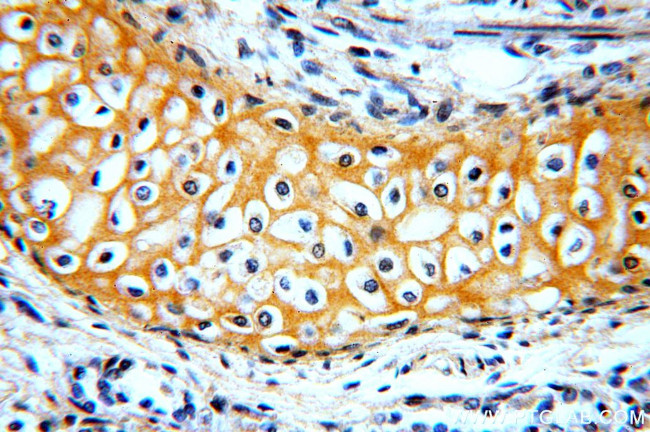 RAB11B Antibody in Immunohistochemistry (Paraffin) (IHC (P))