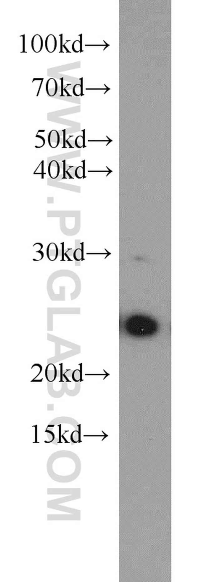 RAB11B Antibody in Western Blot (WB)